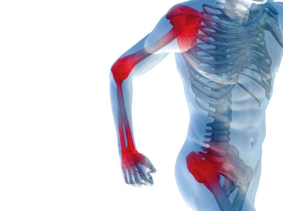 joint pain in arms and legs
