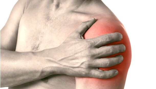 Shoulder Swelling, Redness, and Enlargement - Symptoms of Grade 2-3 Shoulder Arthritis