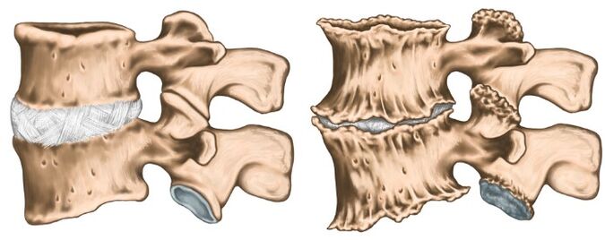 Healthy joints and damage