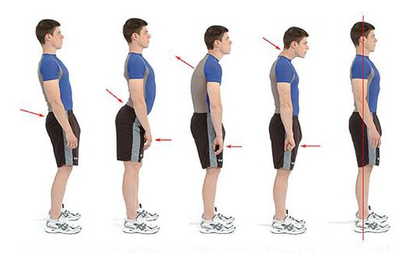 Prevent osteochondral disease