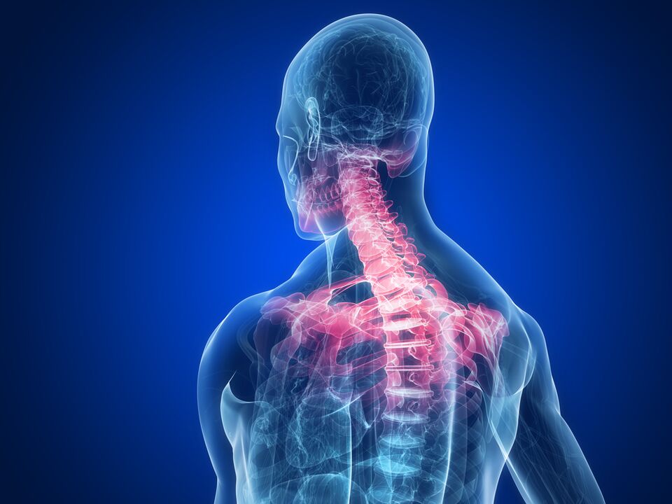 Spondyloarthropathy causes pain between shoulder blades