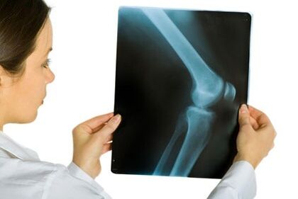 Treat the joints of the knee joints