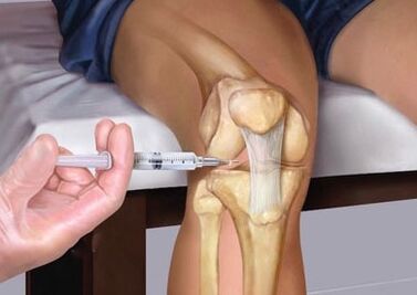 injection