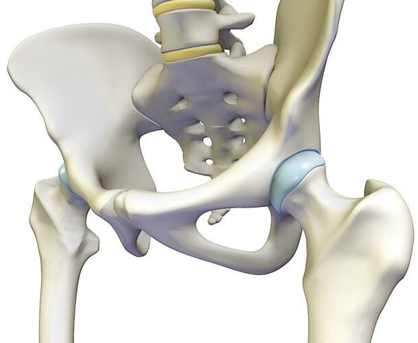 Severe pain in the hip joint caused by osteochondrosis
